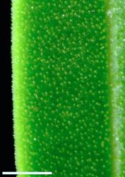 Veronica strictissima. Leaf margin showing minute hairs. Scale = 1 mm.
 Image: P.J. Garnock-Jones © P.J. Garnock-Jones CC-BY-NC 3.0 NZ